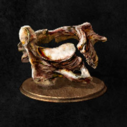 Grillete de vértebras