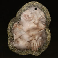 Empa&ntilde;adura sacroderma