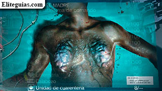 Infección en la Base Madre